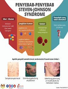 Penyebab-Penyebab Steven-Johnson Syndrome